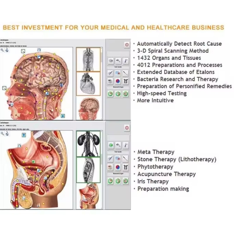 Appareil de biorésonance Metat - Holistic Health & Wellness avis et prix